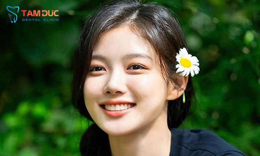 Niềng chỉnh răng kết hợp đánh lún phù hợp với bệnh nhân cười hở lợi nhẹ