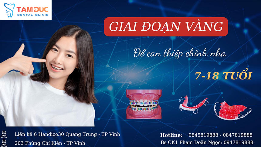 Niềng răng uy tín tại Nghệ An