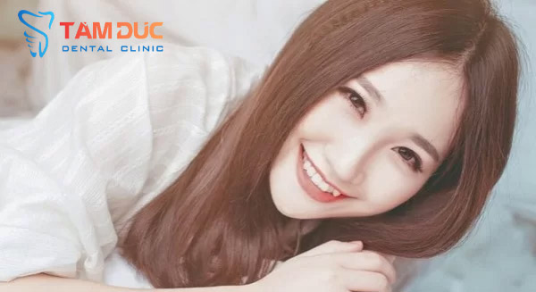 Niềng chỉnh răng khểnh