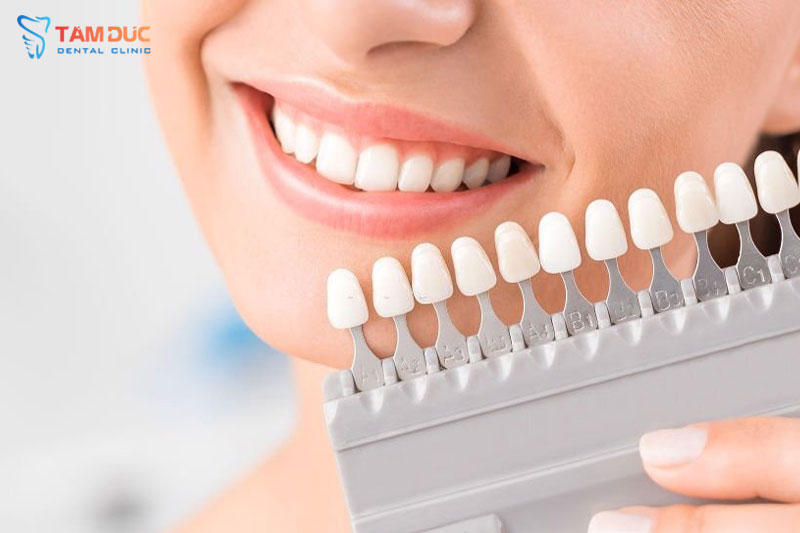 Bọc răng sứ: Thẩm mỹ, bền chắc, lâu dài