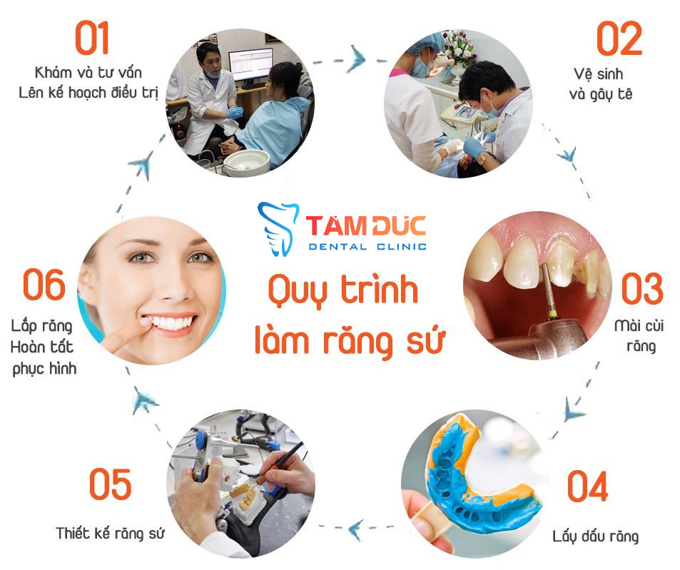 Quy trình làm răng sứ tại Tâm Đức nha khoa