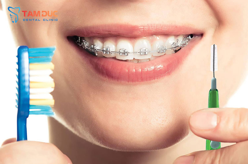 Vệ sinh răng miệng đúng cách