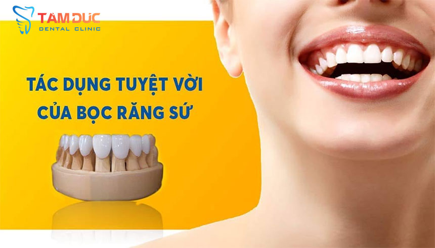 Dịch vụ bọc răng sứ