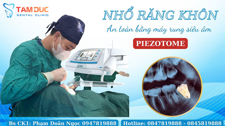 Khách hàng có trải nghiệm thoải mái hơn khi được lấy dấu bằng máy scan trong miệng Itero, Trios