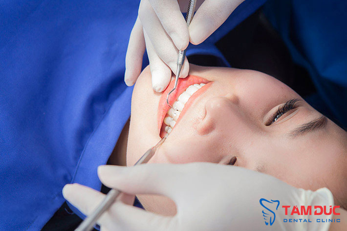 Đính đá kim cương vài răng uy tín tại TP Vinh