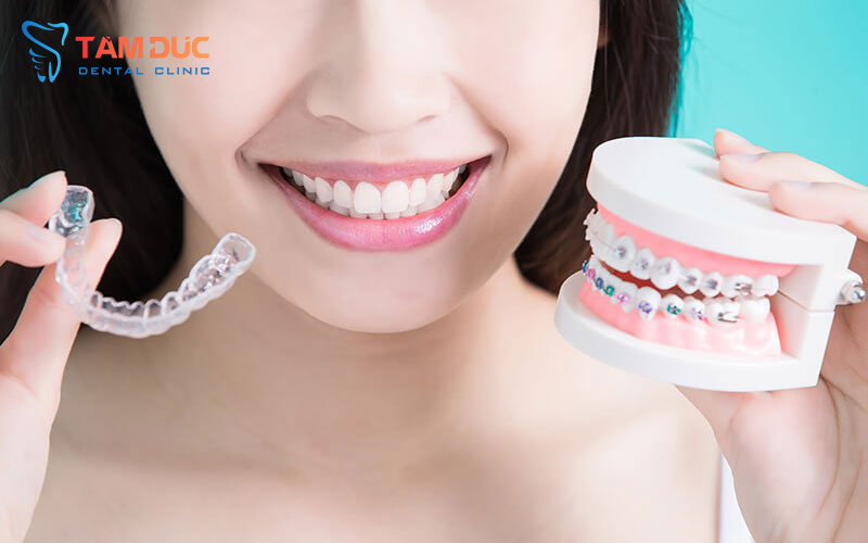 nieng rang dep Nha Khoa Tâm Đức